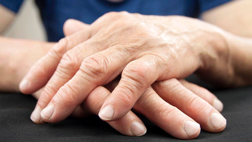 Dấu Hiệu Viêm Khớp Dạng Thấp