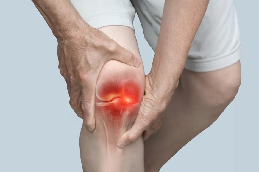 Thoái hóa khớp gối: 4 giai đoạn và phương pháp điều trị không phẫu thuật