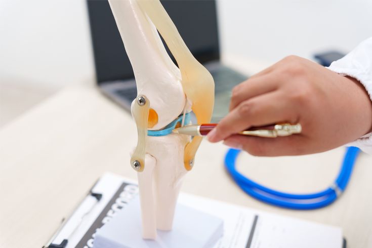 Thoái hóa khớp gối: 4 giai đoạn và phương pháp điều trị không phẫu thuật