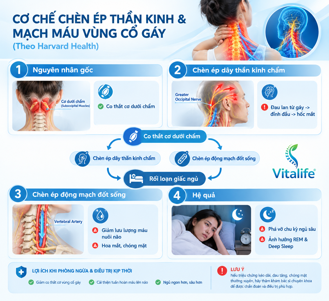 Cơ chế chèn ép dây thần kinh