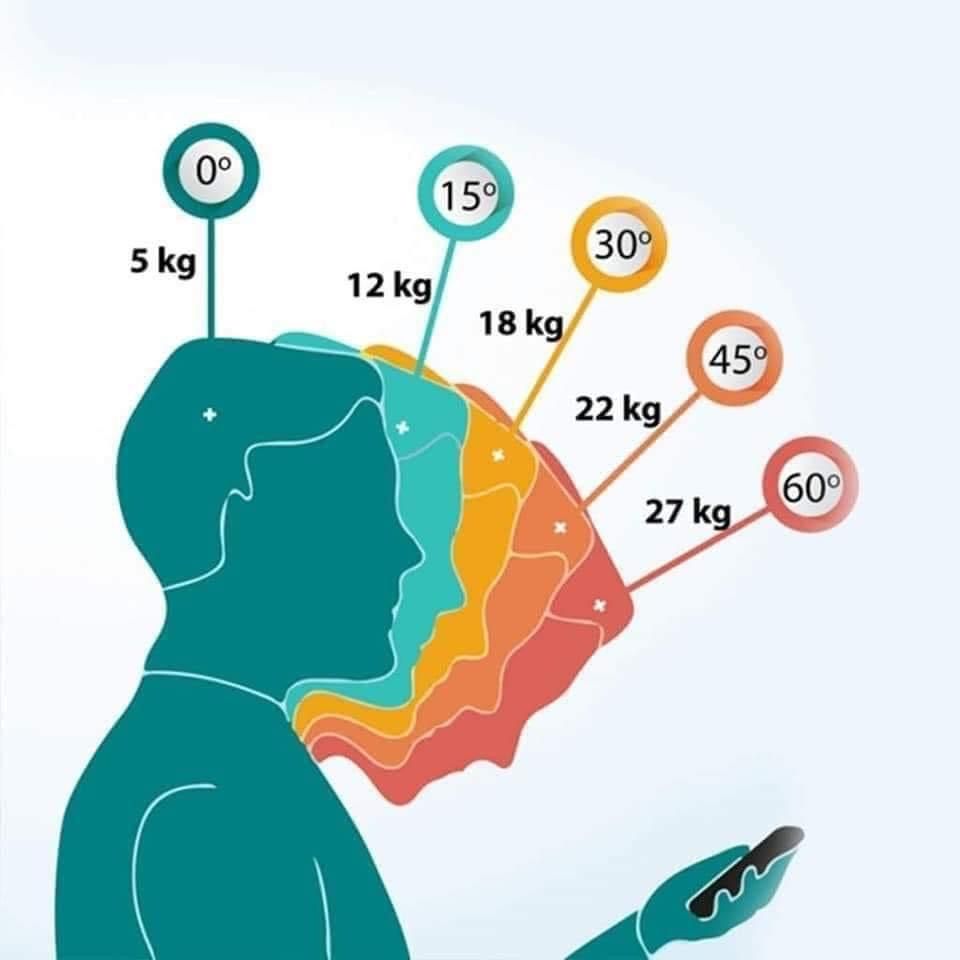 Đau mỏi cổ vai gáy ở giới trẻ do Tech Neck