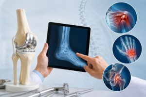 Dịch Vụ Điều Trị Thoái Hóa Các Khớp Uy Tín Tại Hà Nội: Vitalife 16 Thượng Đình